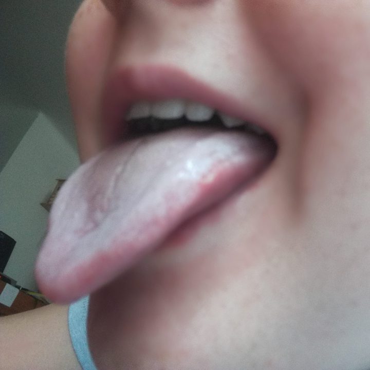 Hubi, hubi nochmal 