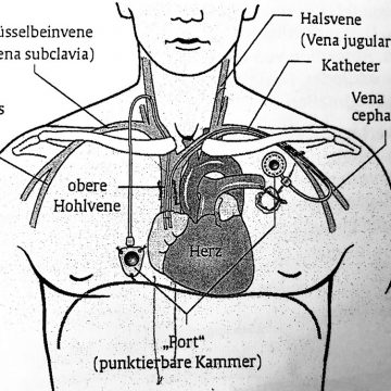 Eulenspiegel PortMann