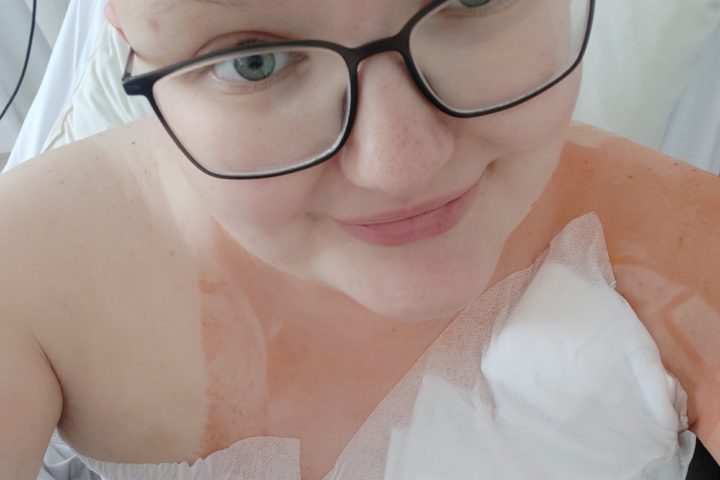 Meine OP – Ablatio rechts, endlich beidseitig flach