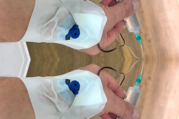 Erlebte Chemotherapie