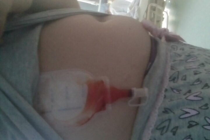 Krankenhausaufenthalt September 2017