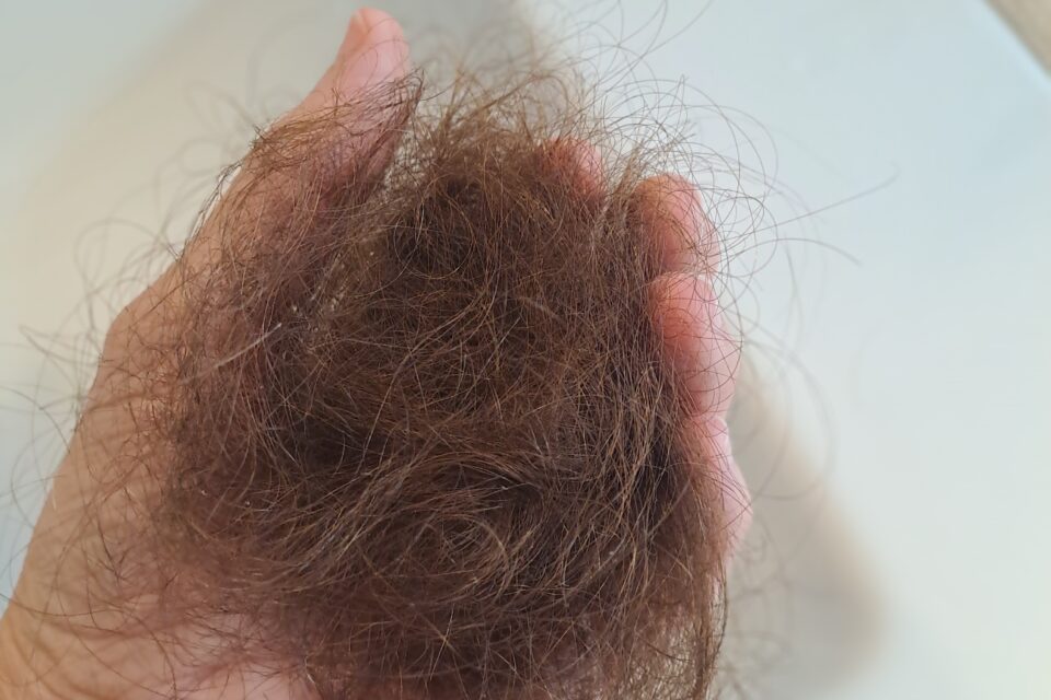 Die ersten Haare gehen aus…