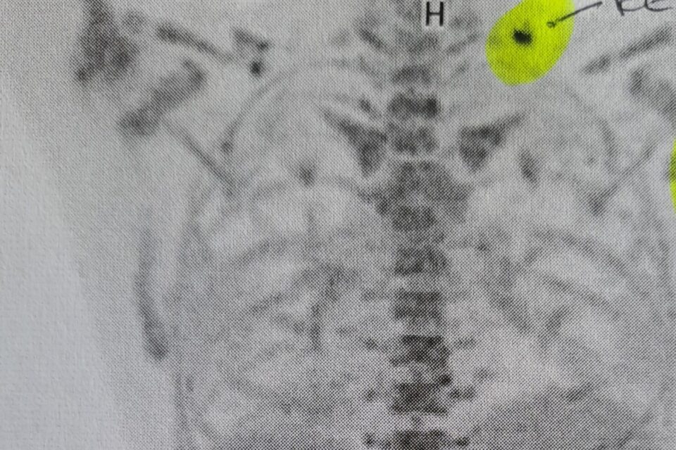 3. Zyklus und mal wieder ein Rückschlag